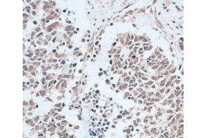 Immunohistochemistry (Paraffin-embedded Sections) (IHC (p)) image for anti-Zinc Finger Protein 416 (ZNF416) antibody (ABIN7258204)