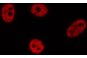 ABIN6272384 staining A549 by IF/ICC. (PEG3 抗体)