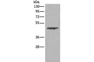 Western blot analysis of A431 cell lysate using ASS1 Polyclonal Antibody at dilution of 1:350 (ASS1 抗体)