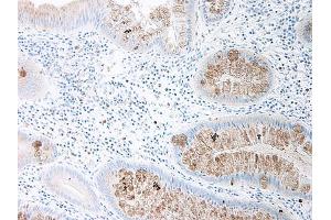 Image no. 1 for anti-Chemokine (C-C Motif) Ligand 15 (CCL15) antibody (ABIN464833) (CCL15 抗体)