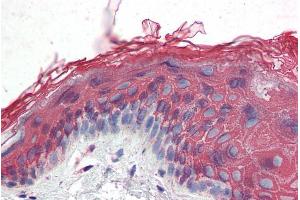 ABIN185540 (3. (ITPR2 抗体  (Internal Region))