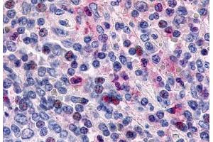 Anti-CCR1 antibody  ABIN1048385 IHC staining of human spleen, lymphocytes. (CCR1 抗体  (Extracellular Domain))