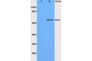 SDS-PAGE (SDS) image for anti-Cytochrome P450, Family 11, Subfamily B, Polypeptide 1 (CYP11B1) (AA 301-400) antibody (ABIN750823)