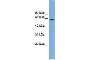 Western Blotting (WB) image for anti-Cytochrome P450, Family 26, Subfamily B, Polypeptide 1 (CYP26B1) (N-Term) antibody (ABIN2787182)
