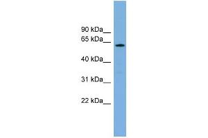 WB Suggested Anti-CYP26B1 Antibody Titration: 0. (CYP26B1 抗体  (N-Term))
