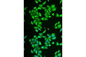 Immunofluorescence analysis of U2OS cells using PGM1 antibody (ABIN5973725). (Phosphoglucomutase 1 抗体)