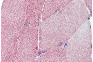Human Skeletal Muscle (formalin-fixed, paraffin-embedded) stained with TEAD4 antibody ABIN462208 followed by biotinylated goat anti-rabbit IgG secondary antibody ABIN481713, alkaline phosphatase-streptavidin and chromogen. (TEAD4 抗体  (C-Term))