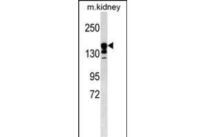 ABCC9 Antibody (Center) (ABIN1538549 and ABIN2849844) western blot analysis in mouse kidney tissue lysates (35 μg/lane). (ABCC9 抗体  (AA 640-669))