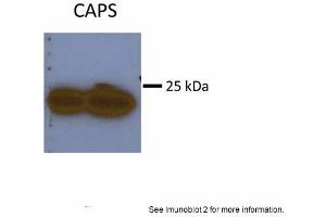 Sample Type: Huh7 HepG2 (50ug)Primary Antibody Dilution:1:500Image Submitted By: Partha KasturiUniversity of Kansas Medical Center (Calcyphosine 抗体  (N-Term))