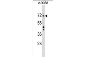 DDX56 Antibody (C-term) (ABIN1537431 and ABIN2848934) western blot analysis in  cell line lysates (35 μg/lane). (DDX56 抗体  (C-Term))