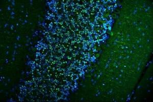 anti-Calcium/calmodulin-Dependent Protein Kinase IV (CAMK4) (AA 19-469) antibody