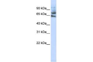 WB Suggested Anti-MCTP1 Antibody Titration:  1 ug/ml  Positive Control:  Jurkat cell lysate (MCTP1 抗体  (Middle Region))