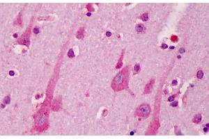 Human Brain, Cortex: Formalin-Fixed, Paraffin-Embedded (FFPE) (A1BG 抗体  (AA 123-172))