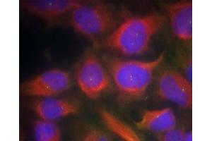 Immunofluorescence staining of methanol-fixed HeLa cells using NMDAR1 (Ab-897) Antibody (E021287, Red) (GRIN1/NMDAR1 抗体)