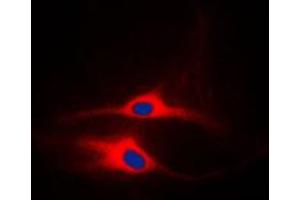 Immunofluorescent analysis of LCK staining in MCF7 cells. (LCK 抗体  (Center))