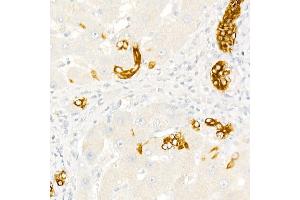 Immunohistochemistry (IHC) image for anti-Keratin 19 (KRT19) (AA 241-400) antibody (ABIN3020779)