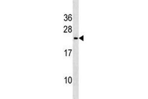 Western Blotting (WB) image for anti-Triggering Receptor Expressed On Myeloid Cells 2 (TREM2) (AA 22-48) antibody (ABIN3029265)