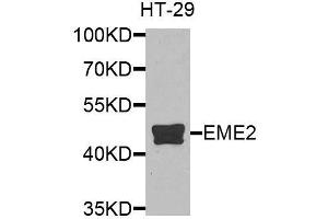Western blot analysis of extracts of HT-29 cells, using EME2 antibody (ABIN6003623) at 1/1000 dilution. (EME2 抗体)