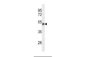 Western Blotting (WB) image for anti-Forkhead Box G1 (FOXG1) (AA 225-252) antibody (ABIN653750)