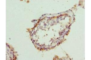 Immunohistochemistry of paraffin-embedded human testis tissue using ABIN7145177 at dilution of 1:100 (BCAP29 抗体  (AA 125-241))