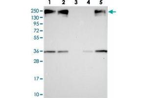 Western blot analysis of Lane 1: RT-4, Lane 2: U-251 MG, Lane 3: Human Plasma, Lane 4: Liver, Lane 5: Tonsil with ZC3H4 polyclonal antibody  at 1:250-1:500 dilution. (ZC3H4 抗体)