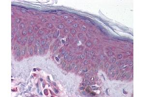 Immunohistochemistry (IHC) image for anti-Gap Junction Protein, beta 1, 32kDa (GJB1) (Middle Region) antibody (ABIN2774854) (GJB1 抗体  (Middle Region))