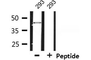 Western blot analysis of extracts from 293, using SYT Antibody. (SS18 抗体  (N-Term))