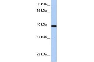 RDH11 antibody used at 1 ug/ml to detect target protein. (RDH11 抗体)