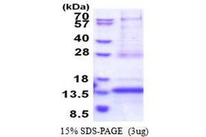 CDKN2A Interacting Protein N-Terminal Like (CDKN2AIPNL) (AA 1-116) protein (His tag)