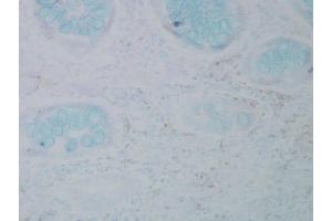 Immunohistochemistry (IHC) image for anti-Nitrotyrosine antibody (ABIN361658)