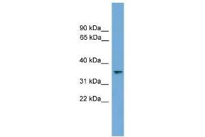 Western Blot showing RAD51L1 antibody used at a concentration of 1-2 ug/ml to detect its target protein. (RAD51 Homolog B 抗体  (Middle Region))