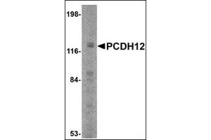 Western blot analysis of PCDH12 in K562 cell lysate with this product at 2 μg/ml. (PCDH12 抗体  (N-Term))