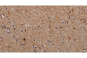 Immunohistochemistry of paraffin-embedded Human brain using NDUFA8 Polyclonal Antibody at dilution of 1:40 (NDUFA8 抗体)