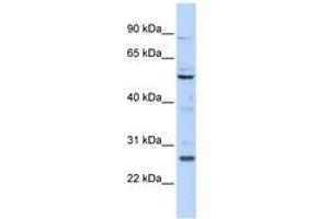 Image no. 1 for anti-Homeobox C5 (HOXC5) (N-Term) antibody (ABIN6740598) (Homeobox C5 抗体  (N-Term))