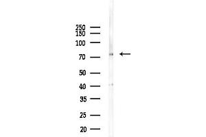 anti-Hormonally Up-Regulated Neu-Associated Kinase (HUNK) (Internal Region) antibody