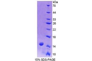 SDS-PAGE (SDS) image for Biglycan (BGN) (AA 230-366) protein (His tag) (ABIN1169936) (Biglycan Protein (BGN) (AA 230-366) (His tag))