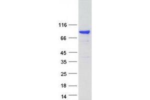 Validation with Western Blot
