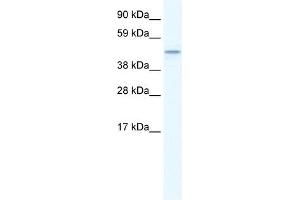 TMEM108 antibody used at 1. (TMEM108 抗体  (Middle Region))