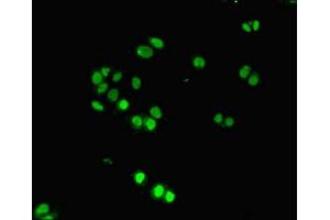Immunofluorescent analysis of PC-3 cells using ABIN7150132 at dilution of 1:100 and Alexa Fluor 488-congugated AffiniPure Goat Anti-Rabbit IgG(H+L)