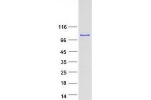 Western Blotting (WB) image for Splicing Factor 4 (SF4) protein (Myc-DYKDDDDK Tag) (ABIN2732608)