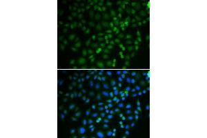 Immunofluorescence (IF) image for anti-Tripartite Motif Containing 21 (TRIM21) (AA 80-330) antibody (ABIN3015762) (TRIM21 抗体  (AA 80-330))