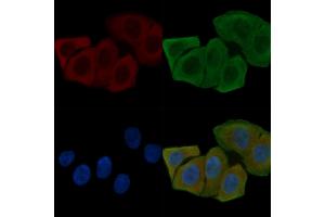 ABIN6261447 and ABIN6268757 staining Hela cells(30 min of UV treatment) by IF/ICC. (FBLN4 抗体  (Internal Region))