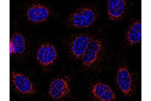 Immunofluorescence staining of HeLa human cervix carcinoma cell line using anti-STIM1 (CDN3H4 ; methanol-aceton fixation; detection by Goat anti-mouse IgG1 Alexa Fluor® 598; red). (STIM1 抗体  (C-Term))