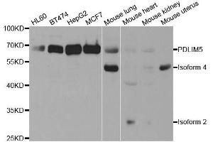 Western blot analysis of extracts of various cell lines, using PDLIM5 antibody. (PDLIM5 抗体  (AA 317-596))