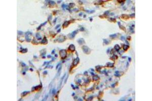 Used in DAB staining on fromalin fixed paraffin-embedded lung tissue (CEACAM6 抗体  (AA 35-142))