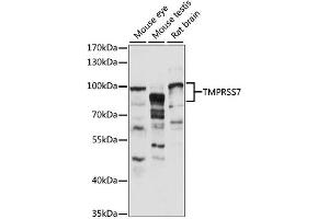 Western blot analysis of extracts of various cell lines, using TMPRSS7 antibody (ABIN6294019) at 1:1000 dilution. (TMPRSS7 抗体)