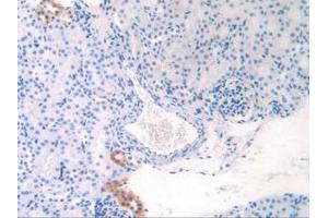 IHC-P analysis of Mouse Kidney Tissue, with DAB staining. (APOC1 抗体  (AA 32-88))