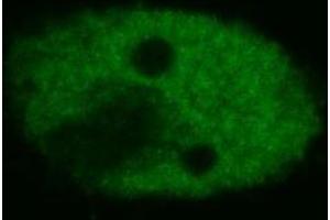 Confocal microscopy of human HeLa cells using anti-p53 (BP53-12 ; FITC). (p53 抗体  (FITC))