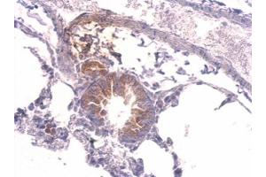 IHC-P Image Tyrosyl tRNA synthetase antibody detects YARS protein at cytosol on mouse lung by immunohistochemical analysis. (YARS 抗体  (C-Term))