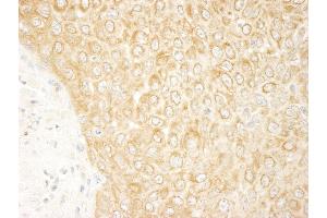 Immunohistochemistry (IHC) image for anti-Mitogen-Activated Protein Kinase Kinase Kinase MLT (ZAK) (AA 750-800) antibody (ABIN7448872)